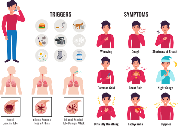 Asthma Symptoms