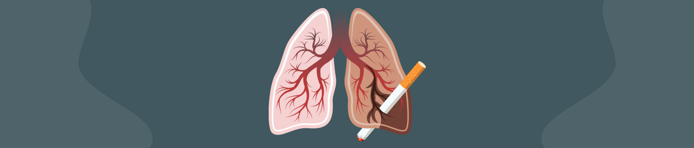 Asthma and Smoking